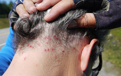 Fight the bite with RESCUE!Â® GoClipÂ® -- an all-natural repellent for